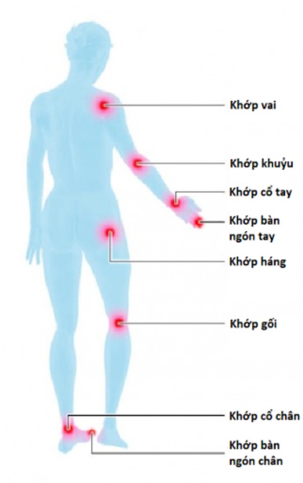 Các khớp thường bị ảnh hưởng trong viêm khớp dạng thấp