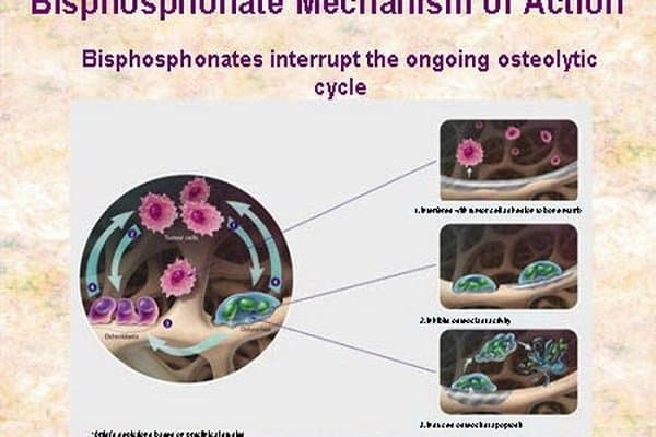 Thuốc Bisphosphonate