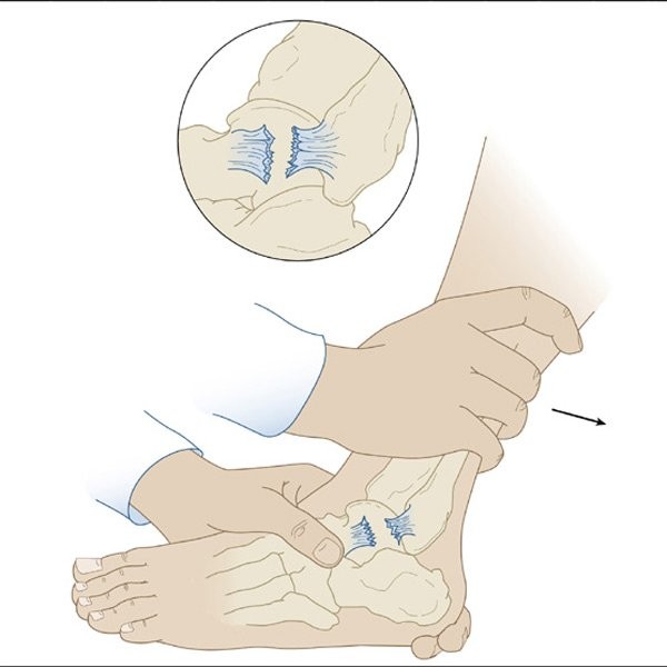 Test kéo trước