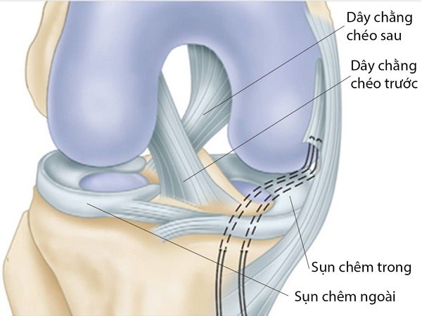 chan-thuong-day-chang-cheo-sau