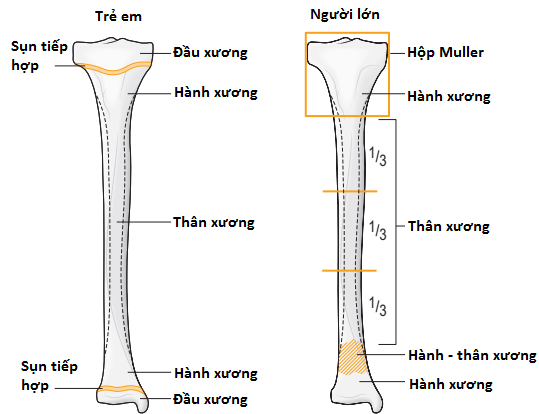 Vị trí gãy xương chân