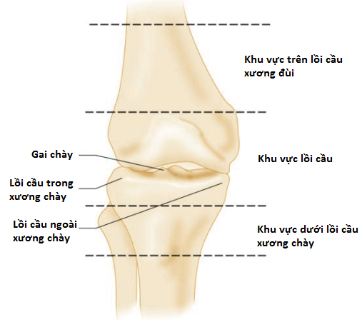 Gãy xương ở khớp gối