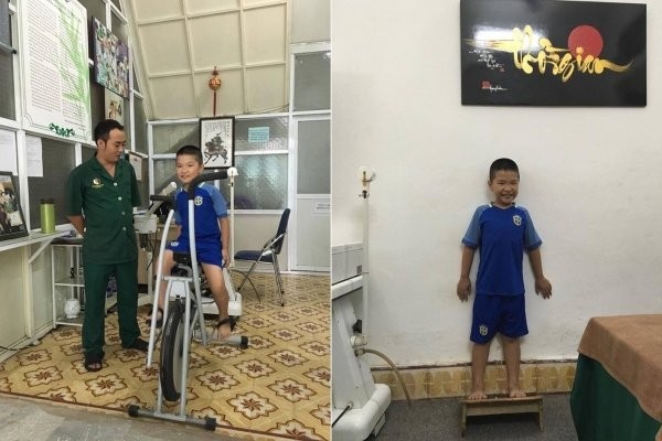 Điều trị loạn dưỡng cơ Duchenne