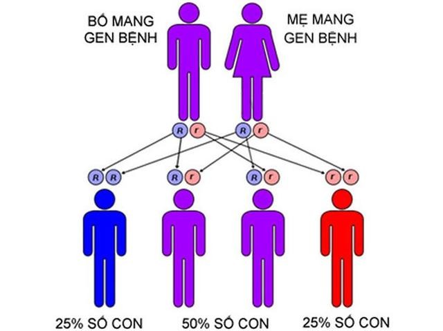 Bệnh teo cơ tủy sống là do di truyền