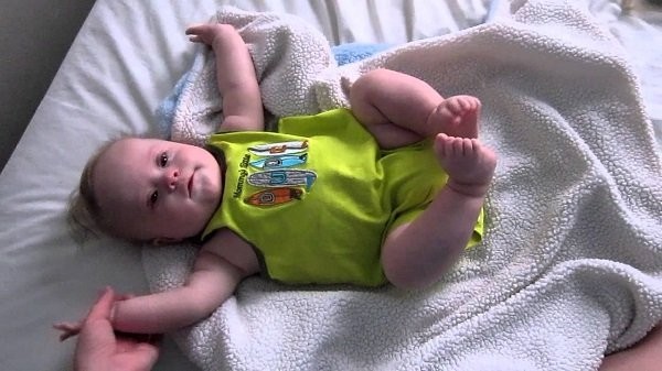 Co thắt ở trẻ sơ sinh (infantile spasms)